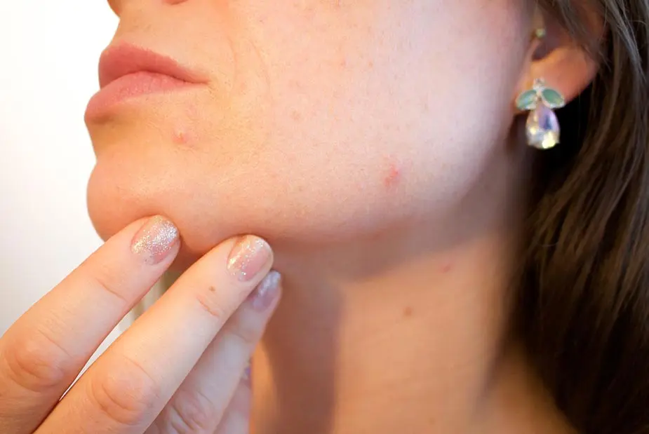 visita dermatologica acne modena