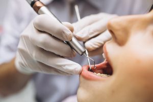differenza tra dentista e ortodontista
